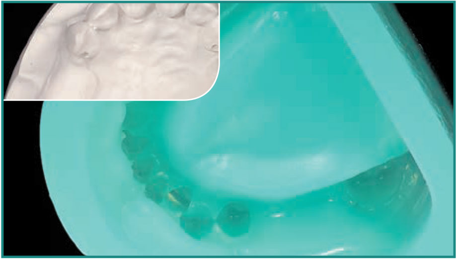 stones-and-plaster-21_13